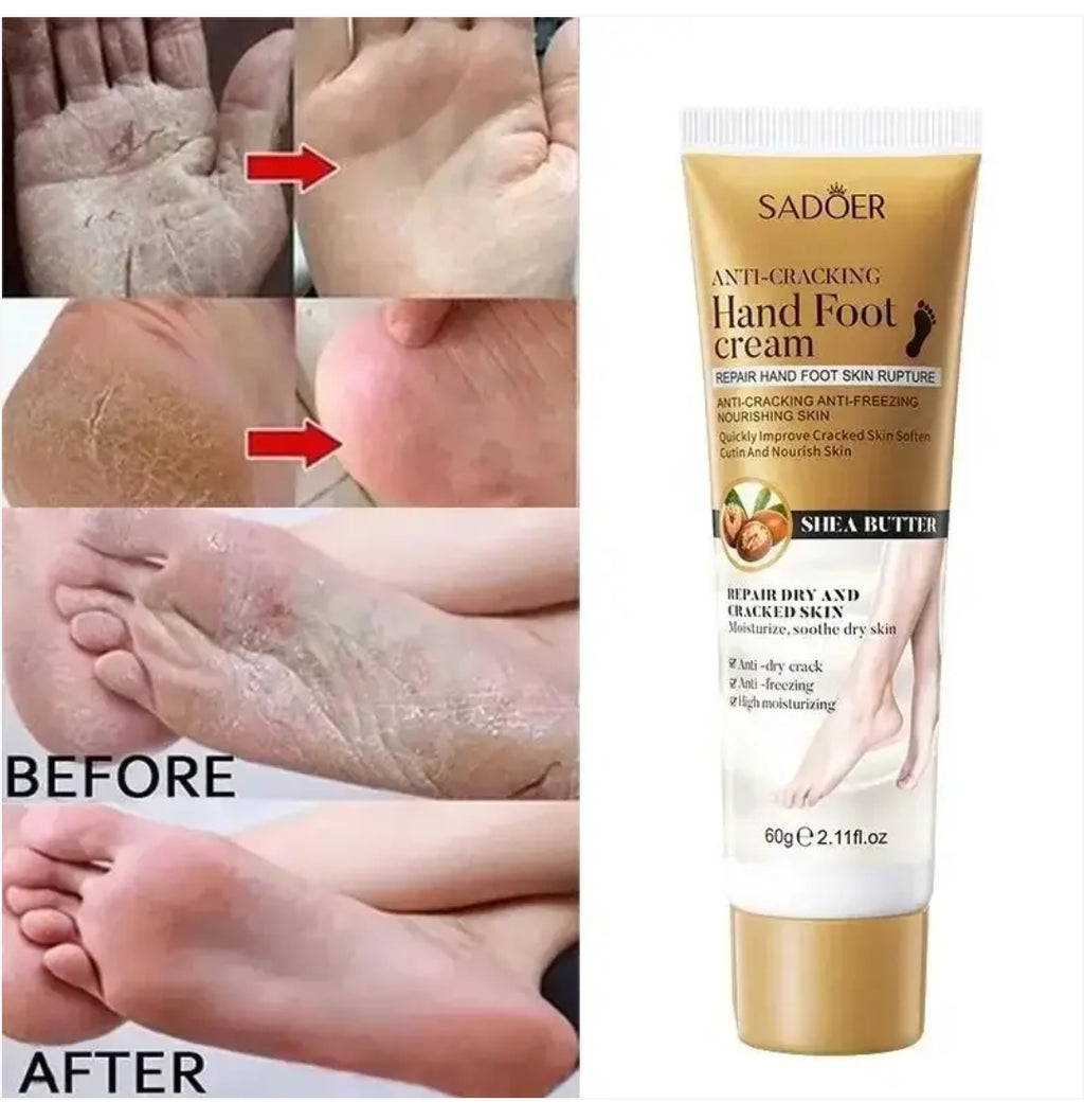 Sadoer anti-cracking hand foot cream 60g